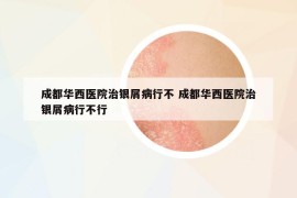 成都華西醫(yī)院治銀屑病行不 成都華西醫(yī)院治銀屑病行不行