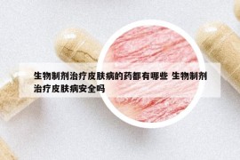 生物制劑治療皮膚病的藥都有哪些 生物制劑治療皮膚病安全嗎