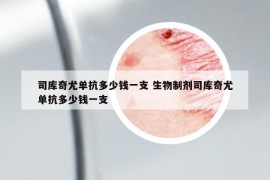 司庫奇尤單抗多少錢一支 生物制劑司庫奇尤單抗多少錢一支