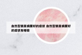 血熱型銀屑病要好的癥狀 血熱型銀屑病要好的癥狀有哪些