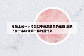 皮膚上長一小片類似于癬深顏色的東西 皮膚上有一小塊像癬一樣的是什么