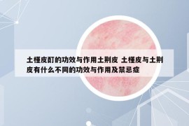 土槿皮酊的功效與作用土荊皮 土槿皮與土荊皮有什么不同的功效與作用及禁忌癥