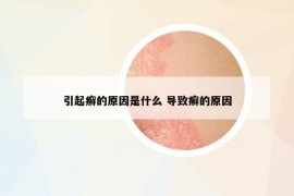 引起癬的原因是什么 導(dǎo)致癬的原因