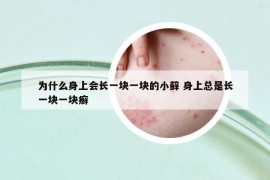 為什么身上會(huì)長(zhǎng)一塊一塊的小蘚 身上總是長(zhǎng)一塊一塊癬