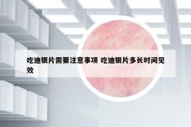 吃迪銀片需要注意事項(xiàng) 吃迪銀片多長時間見效