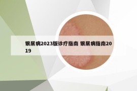 銀屑病2023版診療指南 銀屑病指南2019