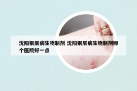 沈陽銀屑病生物制劑 沈陽銀屑病生物制劑哪個醫(yī)院好一點
