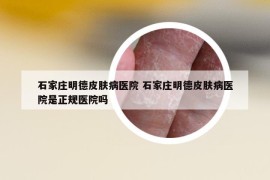 石家莊明德皮膚病醫(yī)院 石家莊明德皮膚病醫(yī)院是正規(guī)醫(yī)院嗎
