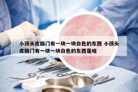 小孩頭皮腦門有一塊一塊白色的東西 小孩頭皮腦門有一塊一塊白色的東西是啥