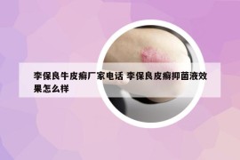 李保良牛皮癬廠家電話 李保良皮癬抑菌液效果怎么樣