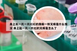 身上長(zhǎng)一片一片紅紅的像癬一樣又癢是什么情況 身上起一片一片紅的又癢是怎么了