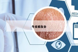 牛皮癬友會