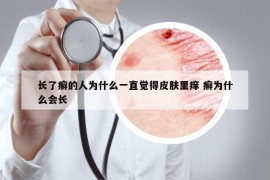長(zhǎng)了癬的人為什么一直覺得皮膚里癢 癬為什么會(huì)長(zhǎng)