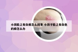 小孩臉上有白癬怎么回事 小孩子臉上有白色的癬怎么辦
