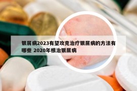 銀屑病2023有望攻克治療銀屑病的方法有哪些 2020年根治銀屑病