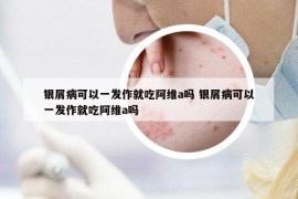 銀屑病可以一發(fā)作就吃阿維a嗎 銀屑病可以一發(fā)作就吃阿維a嗎