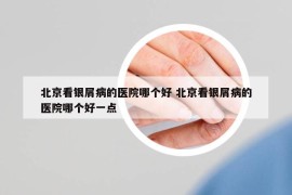 北京看銀屑病的醫(yī)院哪個(gè)好 北京看銀屑病的醫(yī)院哪個(gè)好一點(diǎn)