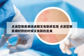 點滴型銀屑病消退期又有新疹出現(xiàn) 點滴型銀屑病好轉的時候又有新的出來