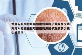 外用人粒細(xì)胞巨噬細(xì)胞刺激因子凝膠多少錢 外用人粒細(xì)胞巨噬細(xì)胞刺激因子凝膠多少錢 生長因子