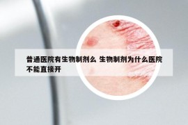 普通醫(yī)院有生物制劑么 生物制劑為什么醫(yī)院不能直接開