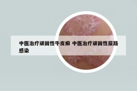 中醫(yī)治療頑固性牛皮癬 中醫(yī)治療頑固性尿路感染