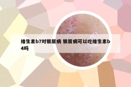 維生素b7對銀屑病 銀屑病可以吃維生素b4嗎