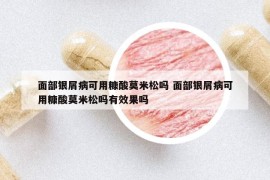 面部銀屑病可用糠酸莫米松嗎 面部銀屑病可用糠酸莫米松嗎有效果嗎