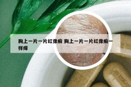 胸上一片一片紅像癬 胸上一片一片紅像癬一樣癢