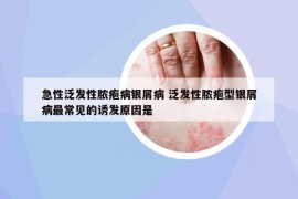 急性泛發(fā)性膿皰病銀屑病 泛發(fā)性膿皰型銀屑病最常見的誘發(fā)原因是