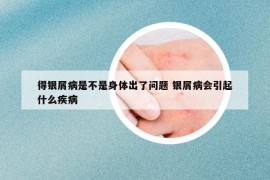 得銀屑病是不是身體出了問(wèn)題 銀屑病會(huì)引起什么疾病