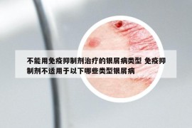 不能用免疫抑制劑治療的銀屑病類型 免疫抑制劑不適用于以下哪些類型銀屑病