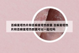 百癬夏塔熱片和百癬夏塔熱膠囊 百癬夏塔熱片和百癬夏塔熱膠囊可以一起吃嗎