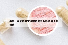 要是一百天的寶寶得銀銷病怎么辦啦 嬰兒銀癬病