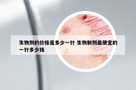 生物劑的價格是多少一針 生物制劑最便宜的一針多少錢