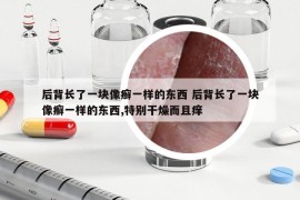 后背長了一塊像癬一樣的東西 后背長了一塊像癬一樣的東西,特別干燥而且癢
