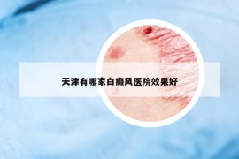 天津有哪家白癜風(fēng)醫(yī)院效果好