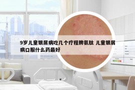 9歲兒童銀屑病吃幾個療程脾氨肽 兒童銀屑病口服什么藥最好