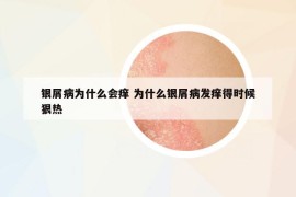 銀屑病為什么會癢 為什么銀屑病發(fā)癢得時候狠熱
