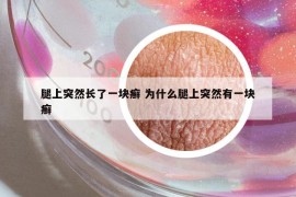 腿上突然長(zhǎng)了一塊癬 為什么腿上突然有一塊癬