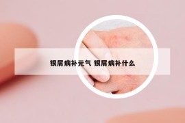 銀屑病補(bǔ)元?dú)?銀屑病補(bǔ)什么