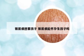 銀屑病想要孩子 銀屑病能懷孕生孩子嗎
