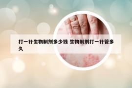 打一針生物制劑多少錢 生物制劑打一針管多久