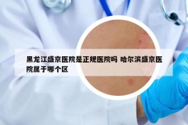 黑龍江盛京醫(yī)院是正規(guī)醫(yī)院嗎 哈爾濱盛京醫(yī)院屬于哪個區(qū)