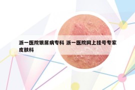 浙一醫(yī)院銀屑病?？?浙一醫(yī)院網(wǎng)上掛號專家皮膚科