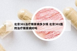 北京301治療銀屑病多少錢 北京301醫(yī)院治療銀屑病好嗎