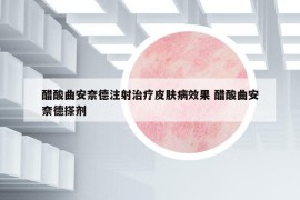 醋酸曲安奈德注射治療皮膚病效果 醋酸曲安奈德搽劑