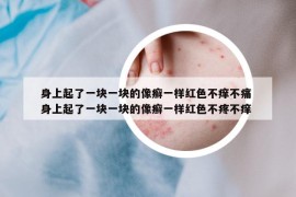 身上起了一塊一塊的像癬一樣紅色不癢不痛 身上起了一塊一塊的像癬一樣紅色不疼不癢