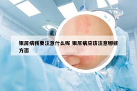 銀屑病我要注意什么呢 銀屑病應(yīng)該注意哪些方面
