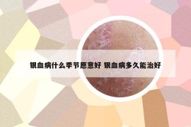 銀血病什么季節(jié)愿意好 銀血病多久能治好