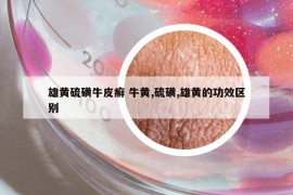 雄黃硫磺牛皮癬 牛黃,硫磺,雄黃的功效區(qū)別